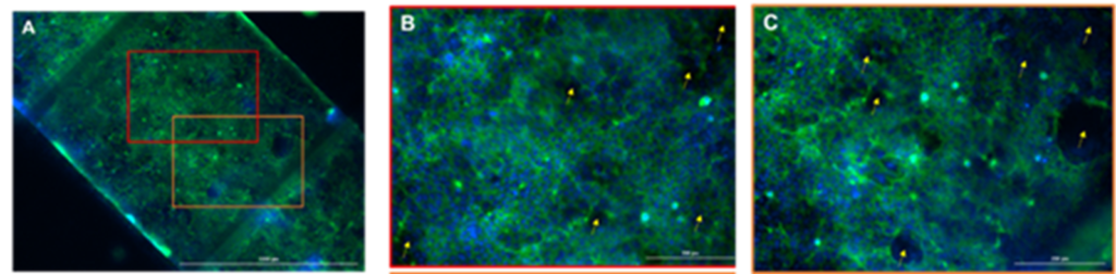 Figure. Immunostaining of Caco-2 cells in PMMA gut-on-a-chip devices after 18 days of culture. Nucleus marker (DAPI) is showed in blue and actin cytoskeleton (Actin-stain™ 488 phalloidin) is showed in green. A: Upper channel seeded with Caco-2 cells. Scale bar: 1000 µm. B: Amplification of the red rectangle in image A. Scale bar: 200 µm. C: Amplification of the orange rectangle in image A. Scale bar: 200 µm.