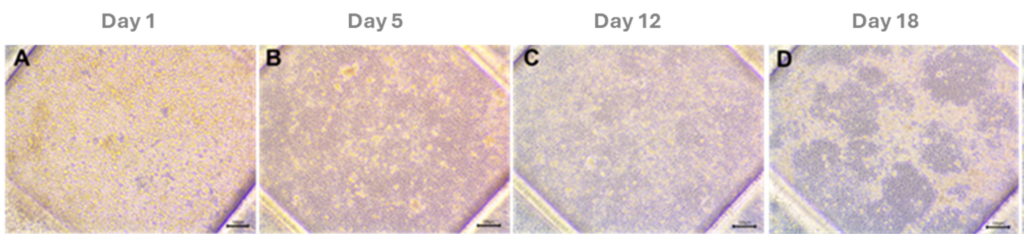 Figure. PMMA gut-on-a-chip device seeded with Caco-2 cells. Phase-contrast microscopy images over a period of 18 days. Scale bar: 100 µm.